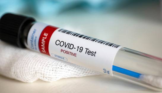 Deloitte criticised for Covid-19 testing role